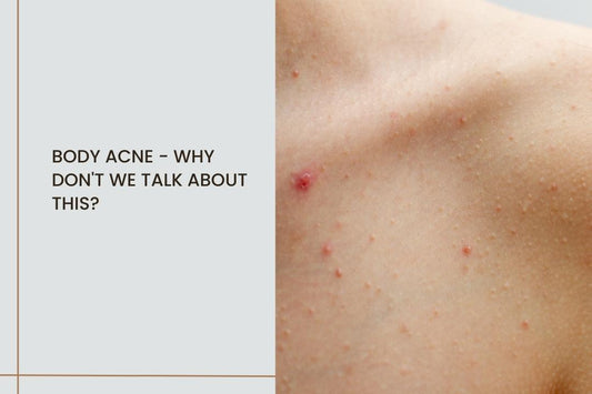 Body acne - why don't we talk about this? - Curl Cure